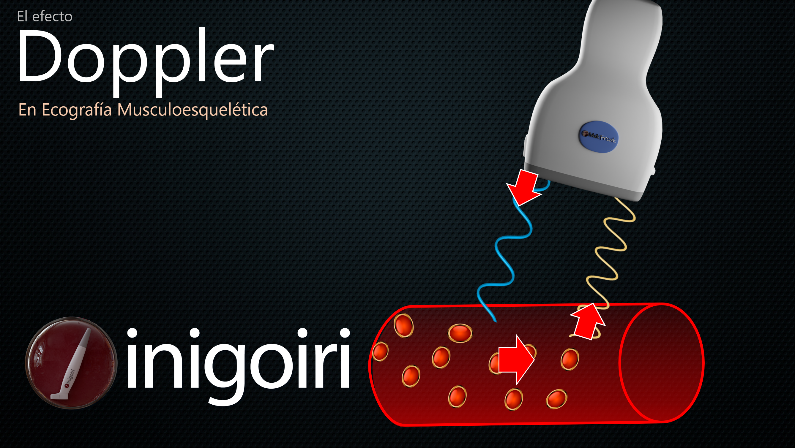 Doppler en Ecografía Musculoesquelética